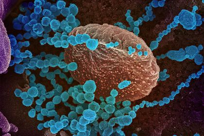 Раскрыты изменения в организме зараженного коронавирусом человека